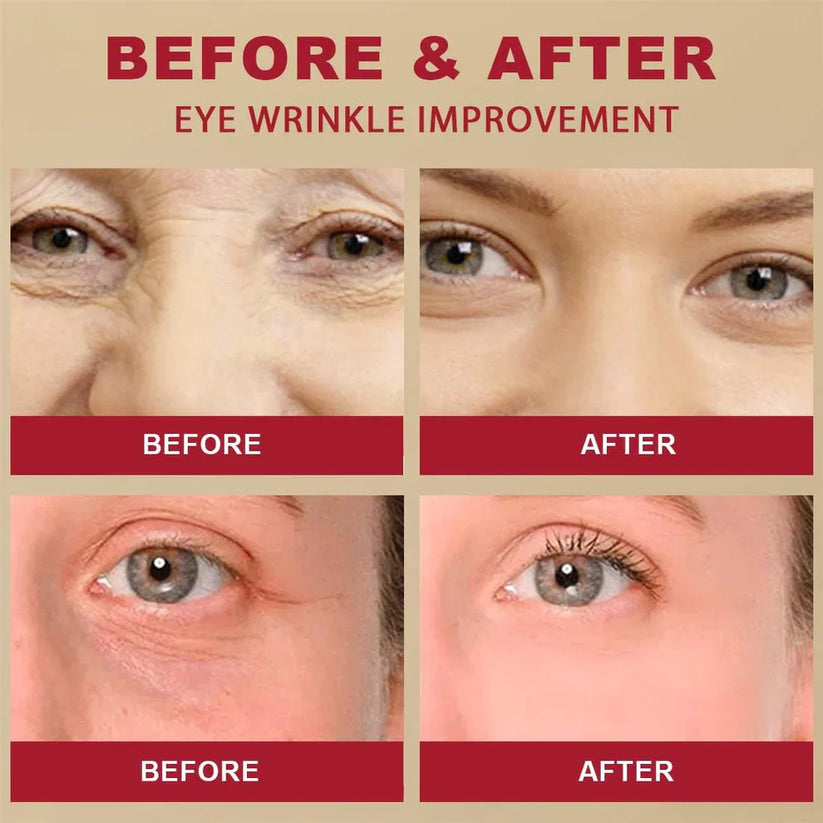 K-SECRET SEOUL 1988 Retinal Eye Cream | Shiny Skin and Sparkling Eyes