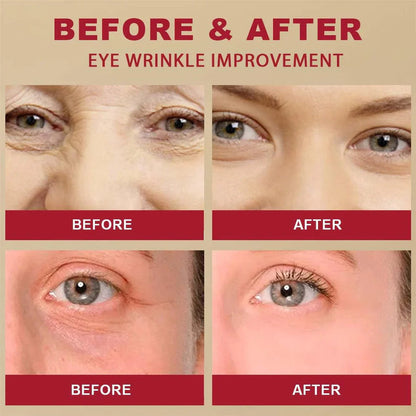 K-SECRET SEOUL 1988 Retinal Eye Cream | Shiny Skin and Sparkling Eyes